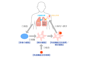 NKT免疫細胞治療について解説します