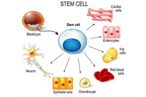 Stem Cell Treatment for Chronic Pain